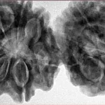 12 MK Gaurishankar 43.8mm 11gm - Inverse xray