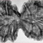 12 MK Gaurishankar 41.9mm 8.78gm - Inverse xray