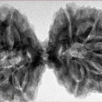 10 Mk Gaurishankar 40.5mm 9.38gm - Inverse xray