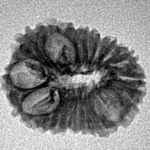 16 Mukhi Rudraksha 18.9mm 1.36gm - Inverse xray