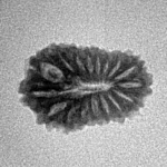 17 Mukhi Rudraksha 17.5mm 1.06gm - Inverse xray