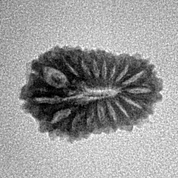 17 Mukhi Rudraksha 17.5mm 1.06gm - Inverse xray