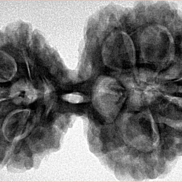 9 MK Gaurishankar 39.9mm 9.17gm - Inverse xray