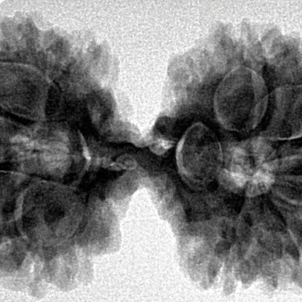 10 Mk Gaurishankar 37.6mm 7gm - Inverse xray