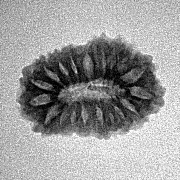 17 Mukhi Rudraksha 19.3mm 1.67gm - Inverse xray