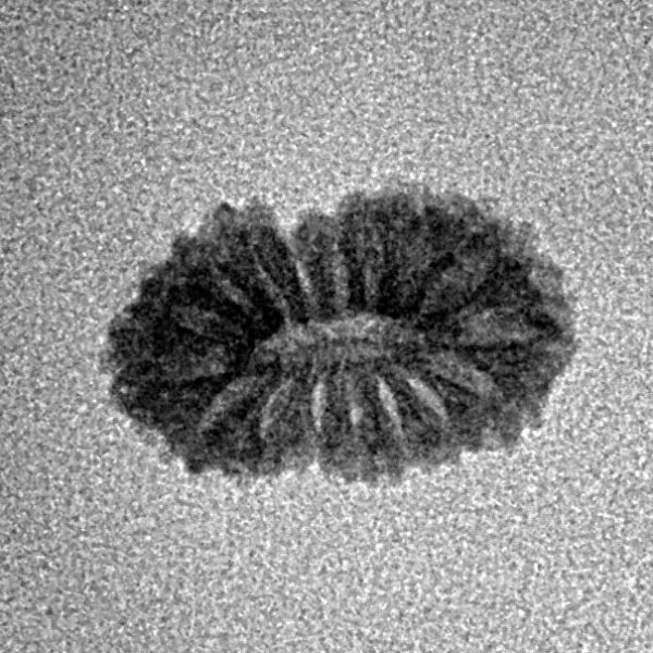 17 Mukhi Rudraksha 14.5mm 0.54gm - Inverse xray