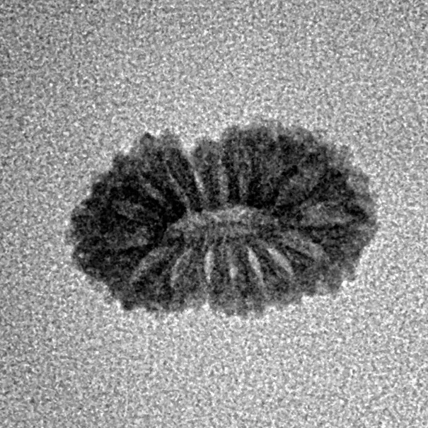 17 Mukhi Rudraksha 14.5mm 0.54gm - Inverse xray