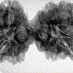 10 Mk Gaurishankar 39mm 8gm - Inverse xray