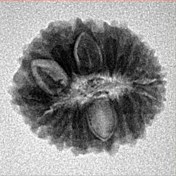 16 Mukhi Rudraksha 19mm 2gm - Inverse xray