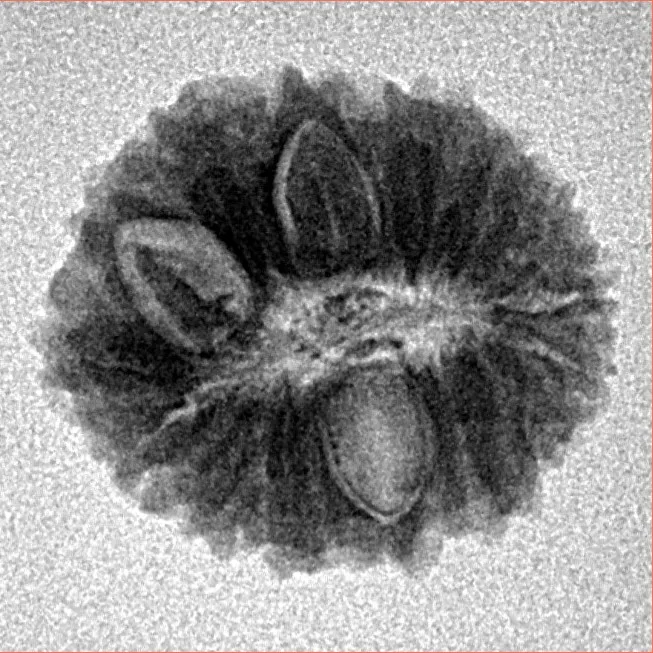 16 Mukhi Rudraksha 19mm 2gm - Inverse xray