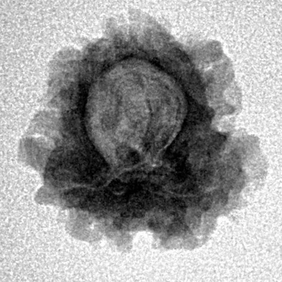 1 Mukhi Rudraksha 18.2mm 1.61gm - Inverse xray