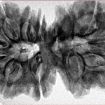 13 MK Gaurishankar 39.3mm 8.26gm - Inverse xray