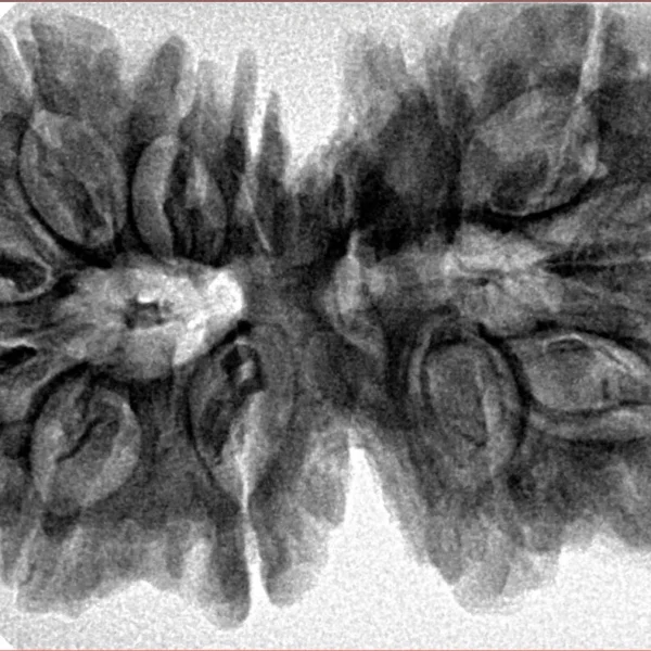 13 MK Gaurishankar 39.3mm 8.26gm - Inverse xray