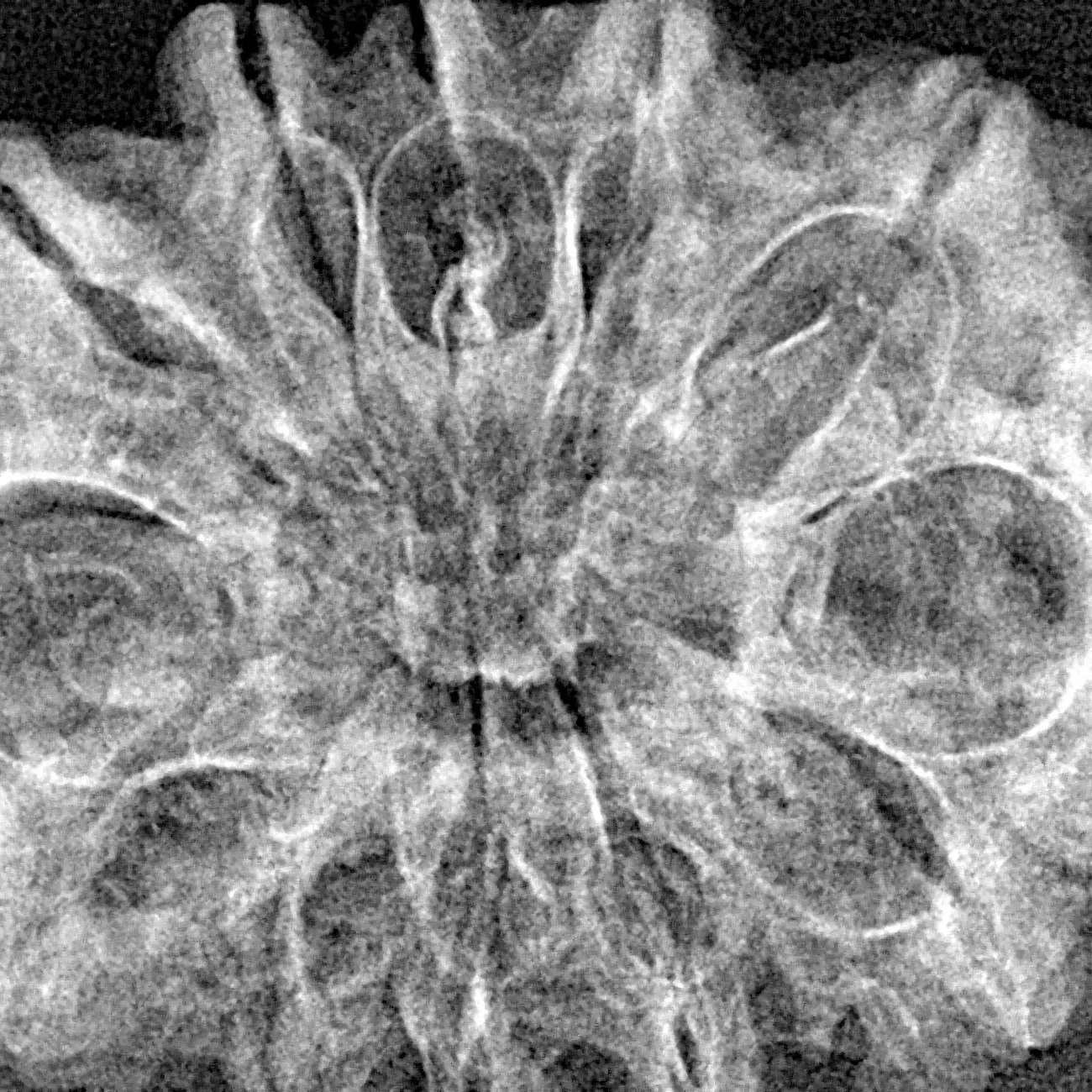12 Mukhi Rudraksha 35mm 5.49gm - Xray