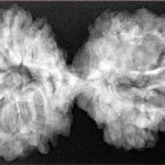 10 Mk Gaurishankar 39.9mm 7.32gm - Xray