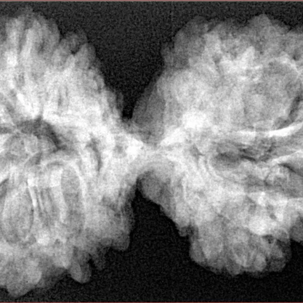 10 Mk Gaurishankar 39.9mm 7.32gm - Xray