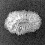 17 Mukhi Rudraksha 18.4mm 1.2gm - Xray