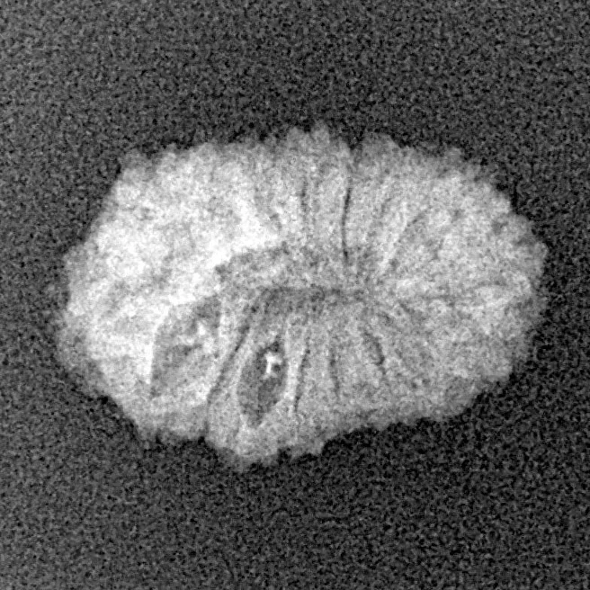 17 Mukhi Rudraksha 18.4mm 1.2gm - Xray