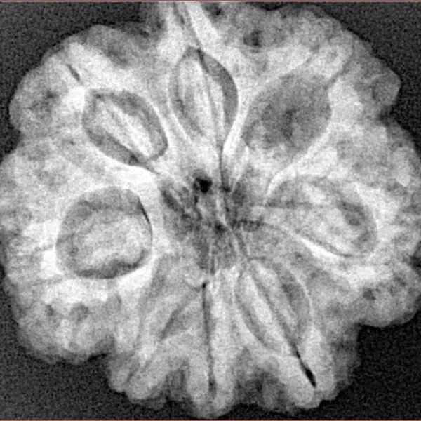 8 Mukhi Rudraksha 26.6mm 6.17gm - Xray