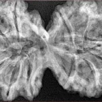 12 MK Gaurishankar 41.9mm 8.78gm - Xray