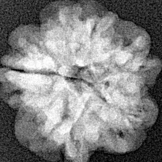 1MK(Underdeveloped) 18.3mm 2.29gm - Xray