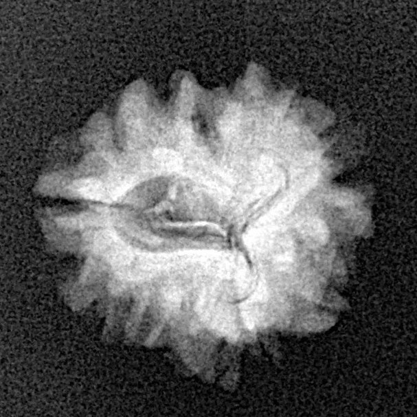 1 Mukhi Rudraksha 18.7mm 1.67gm - Xray