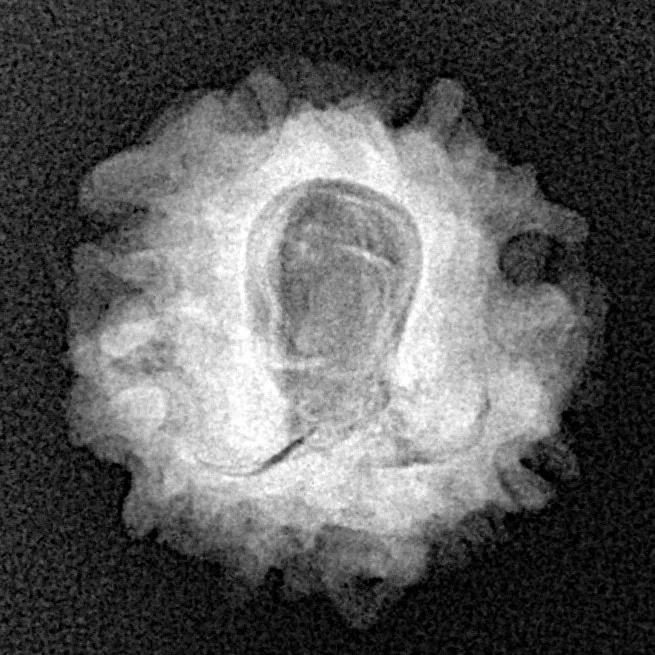 1 Mukhi Rudraksha 20.4mm 2.51gm - Xray