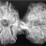 12 MK Gaurishankar 40.5mm 8.83gm - Xray