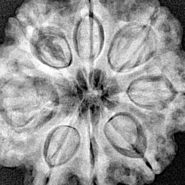 8 Mukhi Rudraksha 29.3mm 6.79gm - Xray