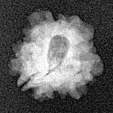 1 Mukhi Rudraksha 14.4mm 0.89gm - Xray