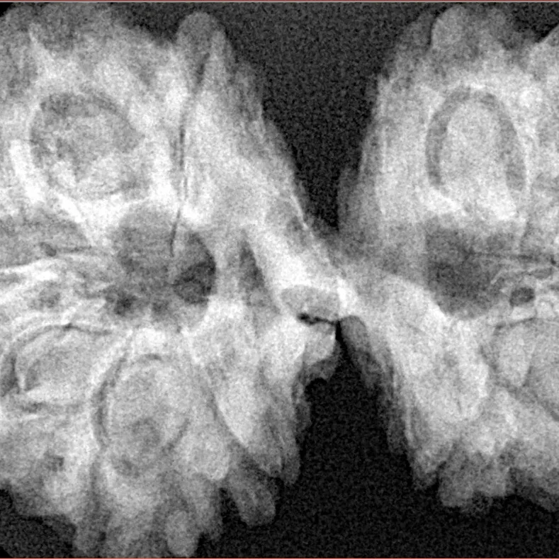 11 MK Gaurishankar 37.2mm 7.17gm - Xray