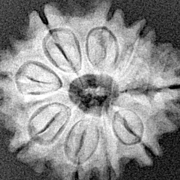 9 Mukhi Rudraksha 22.6mm 3.57gm - Xray