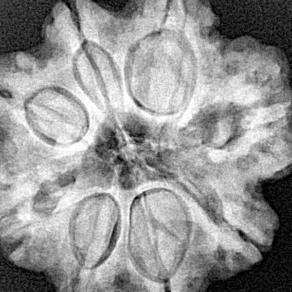 8 Mukhi Rudraksha 26.7mm 5.9gm - Xray