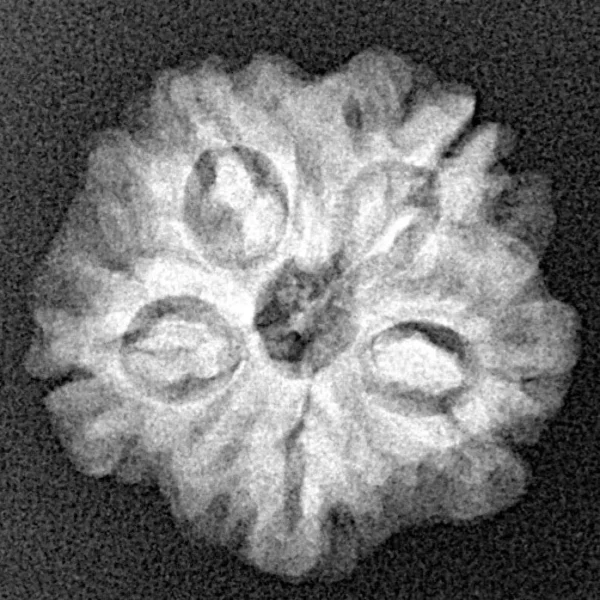 1MK(Underdeveloped) 20.4mm 3.23gm - Xray