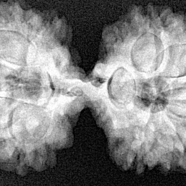 10 Mk Gaurishankar 37.6mm 7gm - Xray