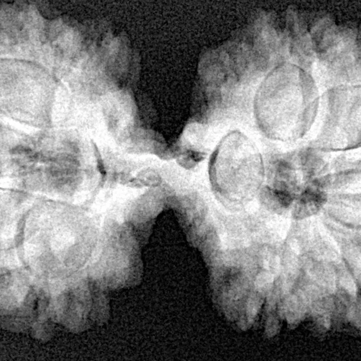 10 Mk Gaurishankar 37.6mm 7gm - Xray