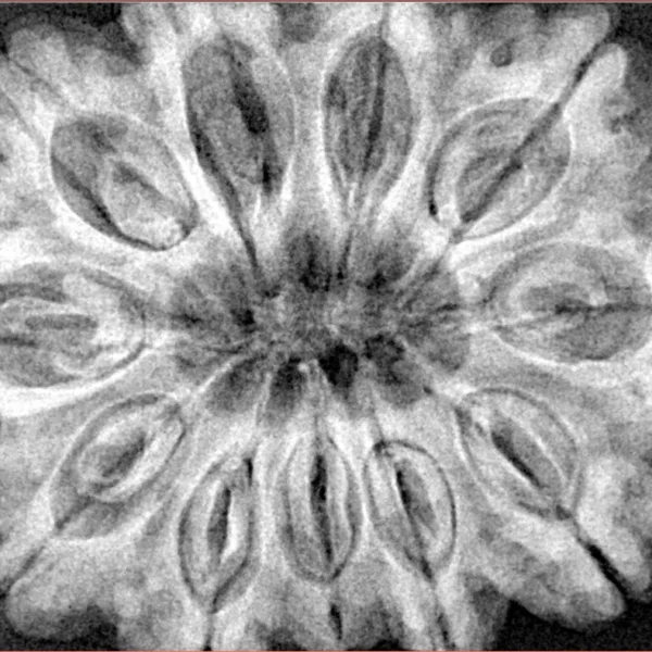 11 Mukhi Rudraksha 34.5mm 9.68gm - Xray