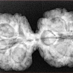 10 Mk Gaurishankar 36.9mm 7.4gm - Xray