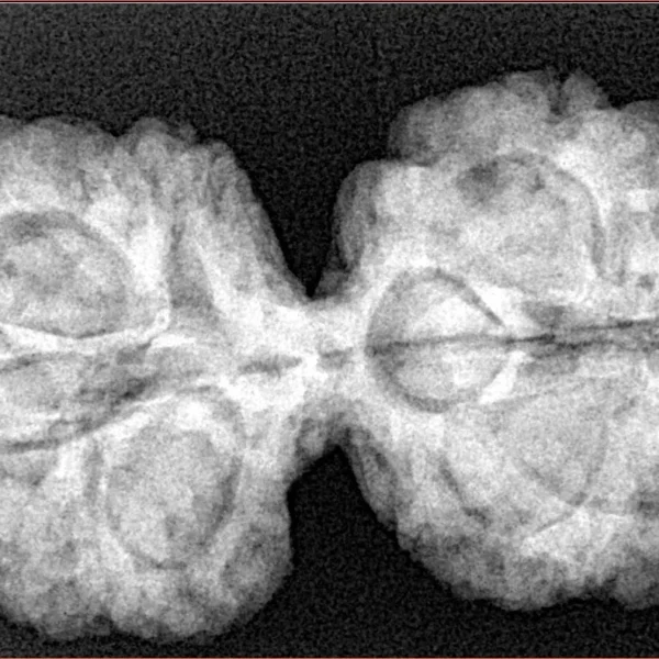 10 Mk Gaurishankar 36.9mm 7.4gm - Xray