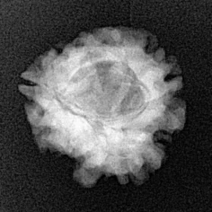 1 Mukhi Rudraksha 20.8mm 2.49gm - Xray