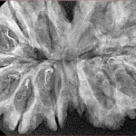 13 MK Gaurishankar 40.3mm 5.86gm - Xray