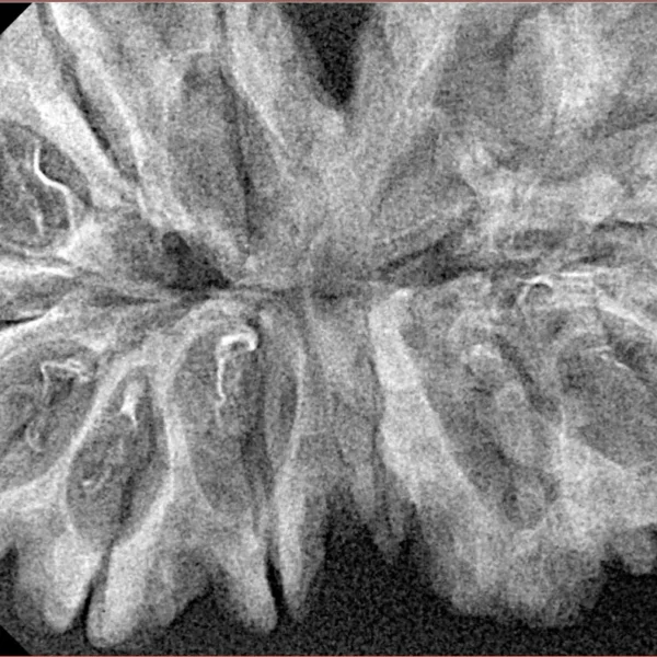 13 MK Gaurishankar 40.3mm 5.86gm - Xray