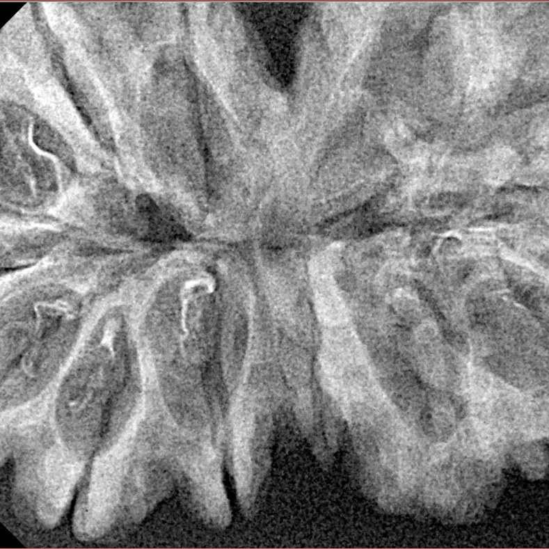 13 MK Gaurishankar 40.3mm 5.86gm - Xray