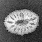 17 Mukhi Rudraksha 18.4mm 1.35gm - Xray