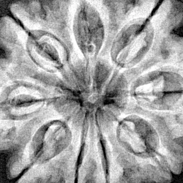 9 Mukhi Rudraksha 31.8mm 7.91gm - Xray