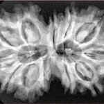 12 MK Gaurishankar 35.6mm 6.18gm - Xray