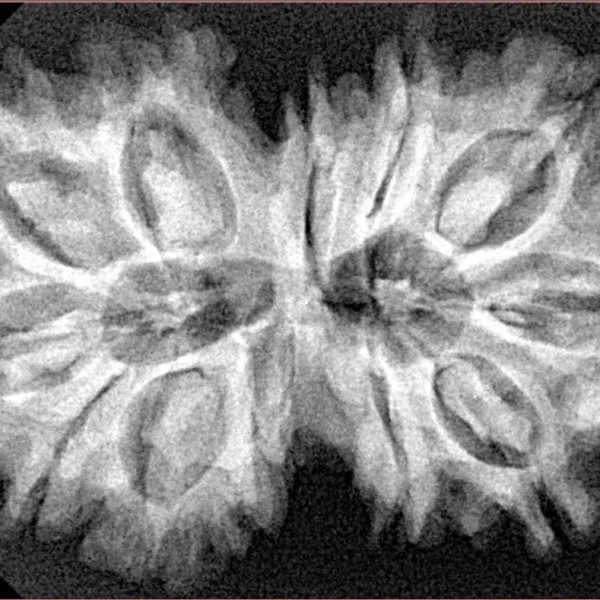 12 MK Gaurishankar 35.6mm 6.18gm - Xray