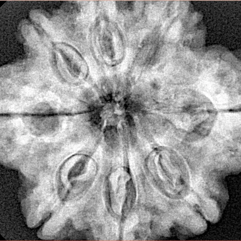 8 Mukhi Rudraksha 29.7mm 7.23gm - Xray