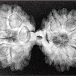 13 MK Gaurishankar 38.3mm 7.11gm - Xray