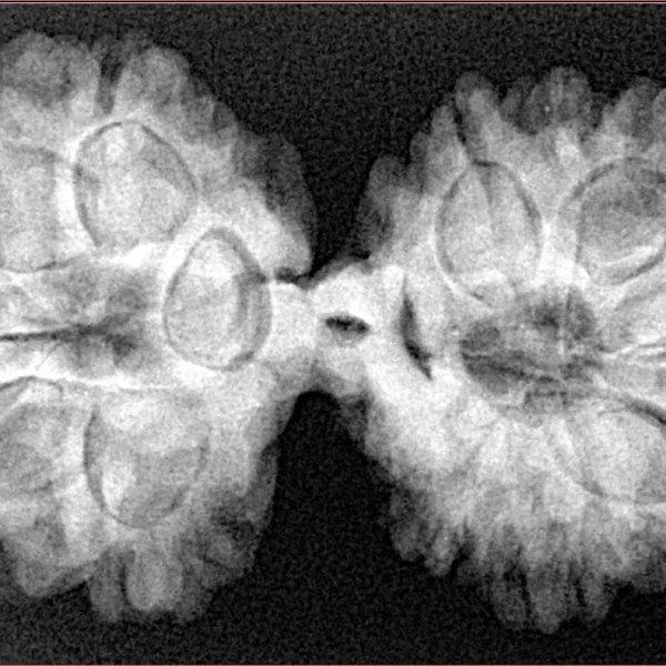 13 MK Gaurishankar 38.3mm 7.11gm - Xray